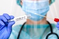 Rusko hlási rekordný prírastok úmrtí na koronavírus: Chorobe podľahli stovky ľudí