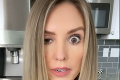 Žena si dala napichať botox okolo očí, hrozivé následky! Tvár bude pred ľuďmi skrývať ešte dlho