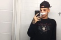 Muž chcel vyzerať ako instagramový filter: Za prerábku tváre vysolil pekný balík! Drsné reakcie ľudí