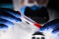 Vedci varujú pred britským variantom koronavírusu: Toto sa pokojne môže stať