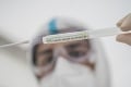 Ministerstvo ohlásilo zmeny: PCR test je zo zdravotného poistenia hradený dvakrát do mesiaca