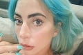 Lady Gaga už nedokázala mlčať: Znásilnenie a totálny psychotický zlom! Prešla si peklom