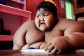 Najtučnejší chlapec na svete zhodil 107 kíl: S novou postavou prišiel ďalší problém