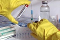 Rekordný počet nakazených v Česku: Za jediný deň potvrdili testy koronavírus u viac než tisíc ľudí