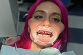 Napichaná Anastasia s dokonalým chrupom ukázala svoje pravé zuby: Šokujúci pohľad do jej úst!