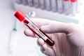 Bezplatné testovanie v Košiciach: Na klinickej štúdii na protilátky sa za prvý týždeň zúčastnili tisíce ľudí