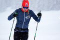 Sympatická fínska lyžiarka: Všimla si to až v sprche, teraz jej hrozí amputácia
