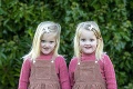 Roztomilé dievčatká sú zrkadlové dvojičky: Začalo sa to diať, keď mali 2,5 roka!