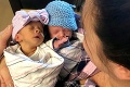 Zázračné puto dvojičiek: Neuveriteľné, čím si museli prejsť hneď od narodenia!