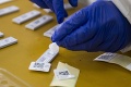 Dokedy sa na Slovensku budú využívať antigénové testy? Veľavravné slová z ministerstva zdravotníctva