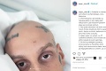 Raper Separ dostal po vyliečení z rakoviny koronavírus: Takú bolesť ešte nezažil