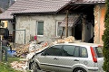 Obrovské nešťastie v Púchove: Výbuch dokaličil školákovi nohy! Susedia prehovorili o dôvode