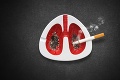 Každé 4 hodiny zabije jedného Slováka: Ako rozpoznať rakovinu pľúc? Jeden fakt obzvlášť desí