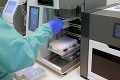 Cesta vzorky od odobratia až po výsledok: Takto sa robí PCR test na koronavírus