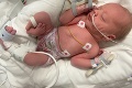 Žena až v 35. týždni zistila, že je tehotná: Porodila chlapčeka, pohľad naň zabolel aj lekárov