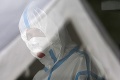 V Česku rapídne pribúda počet hospitalizovaných pacientov: Nevyhli sa ani rastu úmrtí
