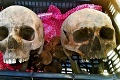 Neuveriteľný nález rodiny z Gbiel: Kopali základy garáže, našli 3 000-ročné kostry! Prilepšia si o nálezné?