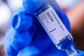 Za piatok pribudlo 552 infikovaných koronavírusom: Hygienici odhalili nové ohnisko nákazy
