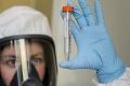 Rusko má prvú vakcínu proti koronavírusu: Veľké obavy mnohých odborníkov! Čo im prekáža?