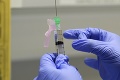 Úspech českých vedcov! Majú prototyp vakcíny proti koronavírusu, testovali ho na hlodavcoch