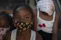 Koronavírus v Brazílii má stovky ďalších obetí: Dôrazná výzva WHO