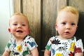 Vystrašená žena začala rodiť predčasne, šok v nemocnici: Malý Oscar sa narodil o dva dni neskôr ako jeho dvojča