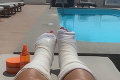 Sexbomba Katie Price po vážnom úraze na dovolenke v Turecku: Má zlomené obe nohy!