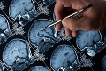 Prelomový objav! Vedci našli spôsob, ako diagnostikovať Alzheimera už 20 rokov pred prvými príznakmi