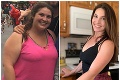 Mladá žena zhodila vďaka extrémnej diéte 50 kíl: Brutálne, ako sa zmenila!