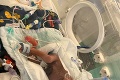 Zázrak! Michaela porodila 450-gramové bábätko: Lekári ho chceli odpojiť od prístrojov, ona odmietla