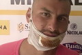 Rusova po nebezpečnom sklze súpera zaliala krv: Trnavského brankára odvážali rovno do nemocnice