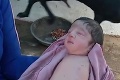 Po pôrode nastalo zhrozenie: Bábätko sa narodilo bez rúk a nôh, vzácna genetická mutácia