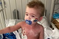 Krutý osud ťažko skúšaného chlapčeka: Dvakrát sa vyliečil z rakoviny, teraz prišla tvrdá rana