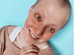 Dcéra Slováčka a Patrasovej má pre rakovinu vlasy na ježka, odfarbila ich na ružovo: S týmto nerátala!