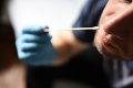 V Česku pribudlo 504 nových prípadov koronavírusu: Dve dávky vakcíny podali už trom miliónom ľudí