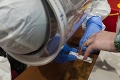 Testovanie na protilátky v Košiciach: 25 ľudí dostalo správu, ktorú čakali najmenej