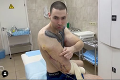 Ruský kulturista Pepek námorník: Bicepsy plné vazelíny mu hnijú, hrozí mu amputácia?