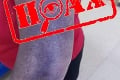 Jano zverejnil fotku fialovej ruky: Následok po očkovaní?! Policajti odhalili pravdu