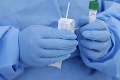 Koniec masovým skríningom? Vláda schválila zrušenie nákupu antigénových testov
