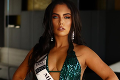 Finalistku Miss World skúmal tucet psychiatrov: Priznanie, po ktorom od nej budú chlapi utekať