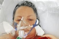 Monika bojovala o život, s covidom ležala dva mesiace v nemocnici: Nepripúšťala som si, že zomriem