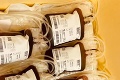Slováci sa prekonali v darovaní najvzácnejšej tekutiny: Takéto číslo ešte nemali! Zlatomoravecká nemocnica trhla rekord
