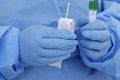 Čo sa deje v Nemecku vyvoláva otázniky: Úrady vyšetrujú možný podvod s testami na koronavírus