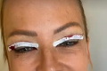 Belohorcová si dala vylepšiť tvár plastickým chirurgom: Zakrvavená fotka tesne po