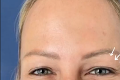 Belohorcová si dala vylepšiť tvár plastickým chirurgom: Zakrvavená fotka tesne po