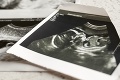 Zúfalá žena sa po potrate prezliekla za sestričku: Čo sa stalo potom, sa ospravedlniť nedá