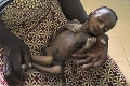 Hladomor hrozí desiatkam miliónov ľudí: Srdcervúce upozornenie OSN