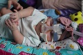 Najmenšie bábätko sveta vážilo po narodení 212 gramov: Rodičia ho po ROKU zobrali z nemocncie
