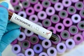 Stovky infikovaných v Česku: Reprodukčné číslo koronavírusu od minulého týždňa kleslo