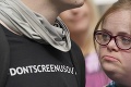 Žena s Downovým syndrómom žaluje britskú vládu: Veľké sklamanie!